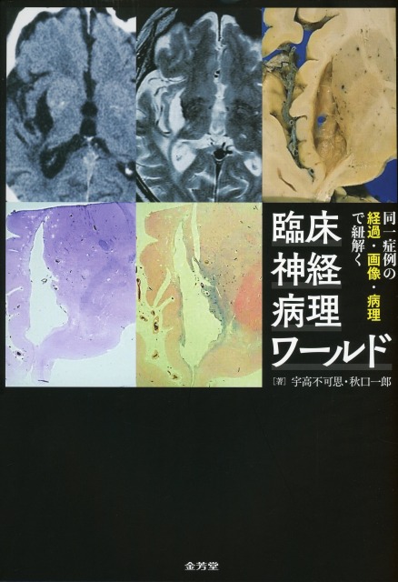 同一症例の経過・画像・病理で紐解く　臨床神経病理ワールド