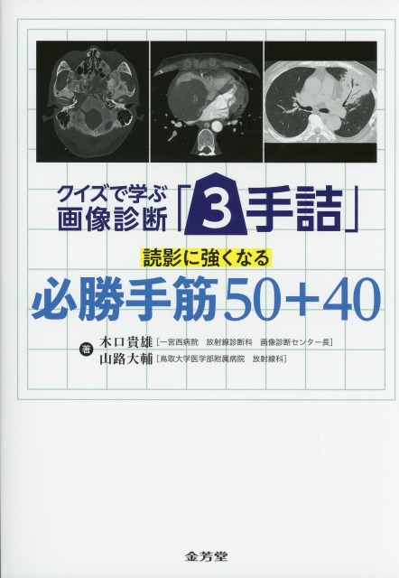 クイズで学ぶ画像診断「3手詰」　読影に強くなる必勝手筋50+40