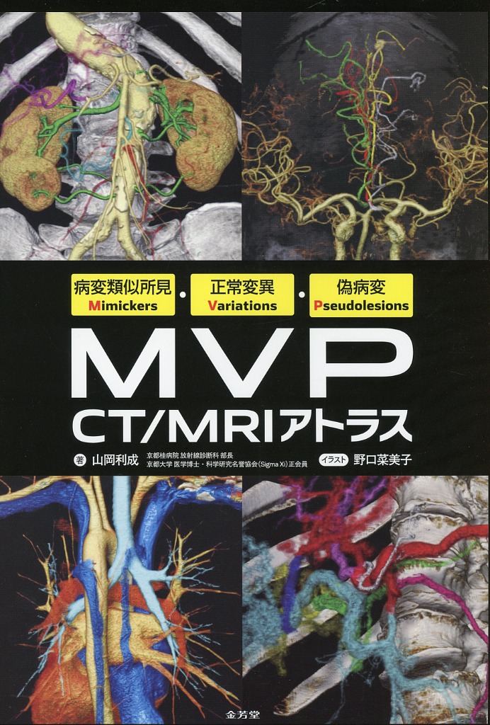 病変類似所見Mimickers・正常変異Variations・偽病変Pseudolesions　MVP CT/MRIアトラス