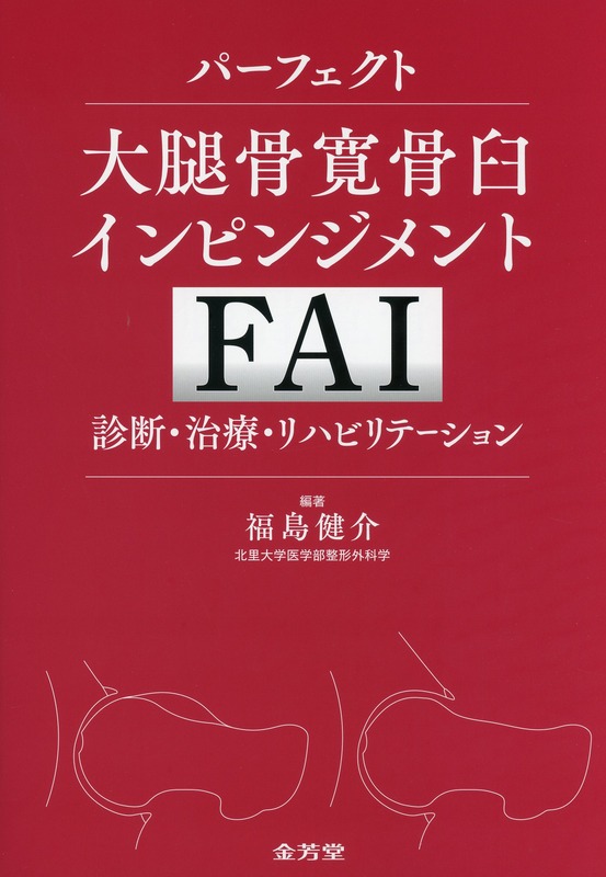 パーフェクト大腿骨寛骨臼インピンジメント（FAI）　診断・治療・リハビリテーション