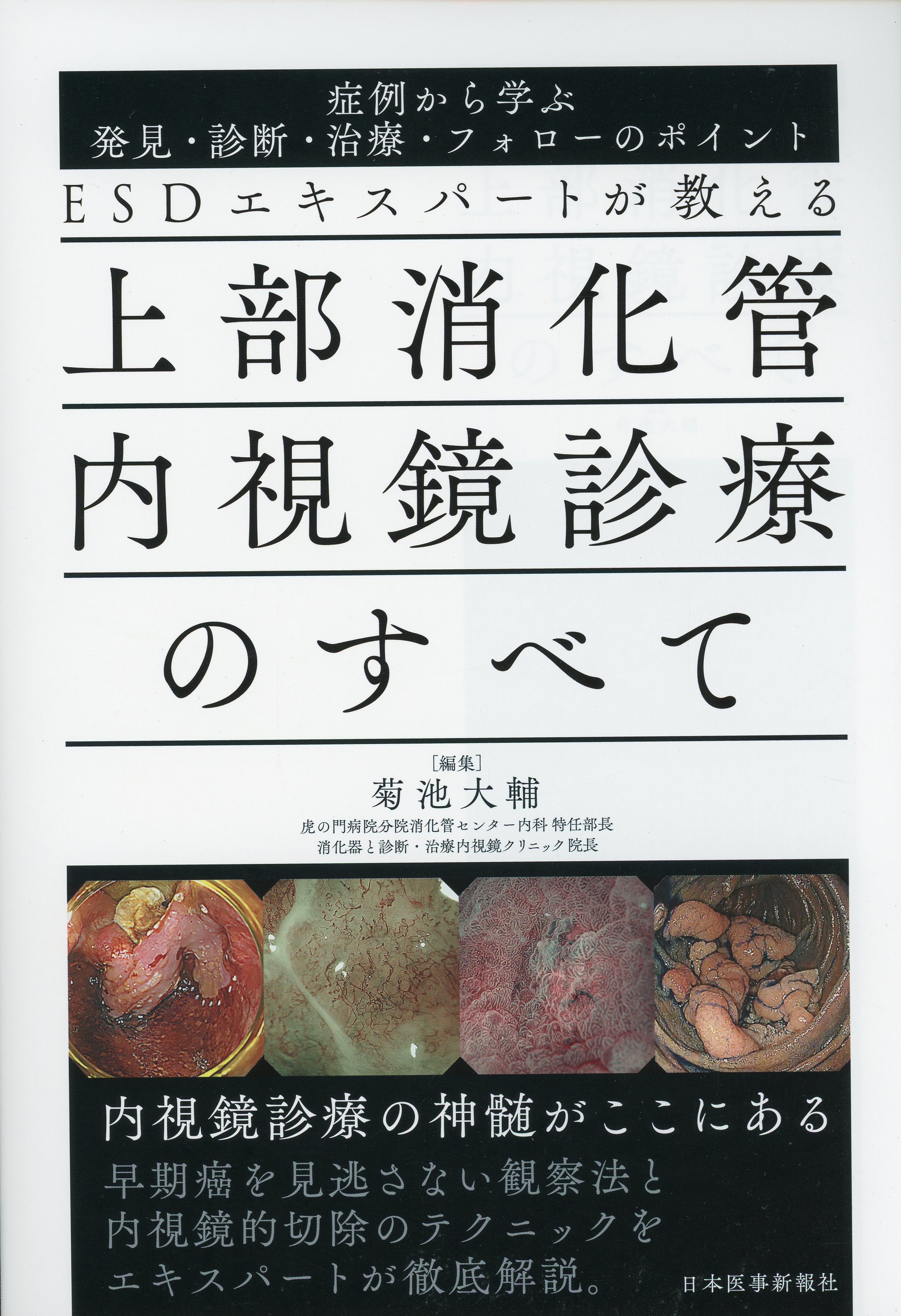 ESDエキスパートが教える 上部消化管内視鏡診療のすべて