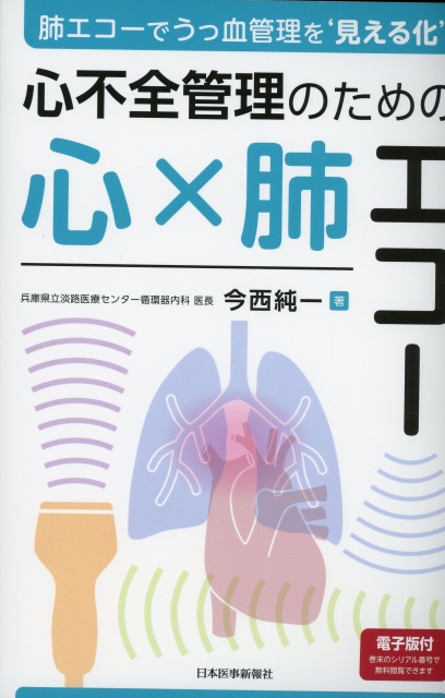 肺エコーでうっ血管理を‘見える化’　 心不全管理のための心×肺エコー