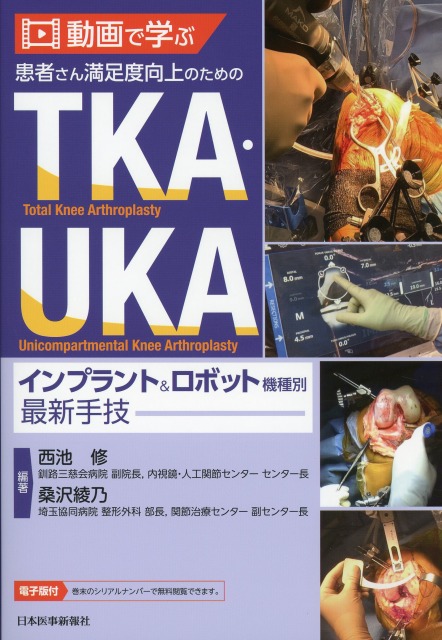 動画で学ぶ　患者さん満足度向上のためのTKA・UKA