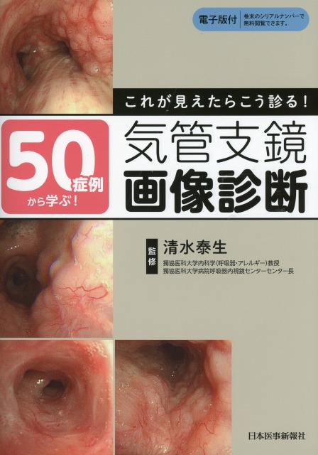 50症例から学ぶ！これが見えたらこう診る！気管支鏡画像診断