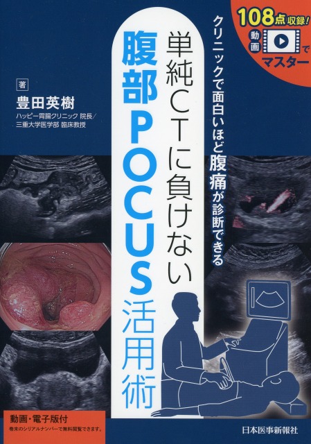 単純CTに負けない腹部POCUS活用術