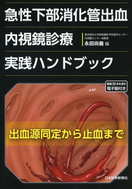 急性下部消化管出血　内視鏡診療実践ハンドブック　出血源同定から止血まで