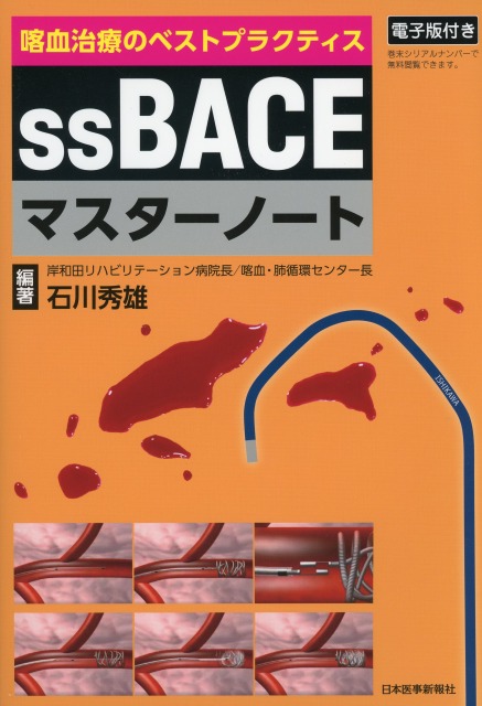 喀血治療のベストプラクティス ssBACEマスターノート