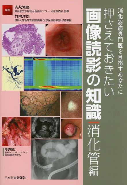消化器病専門医を目指すあなたに　押さえておきたい画像読影の知識　消化管編