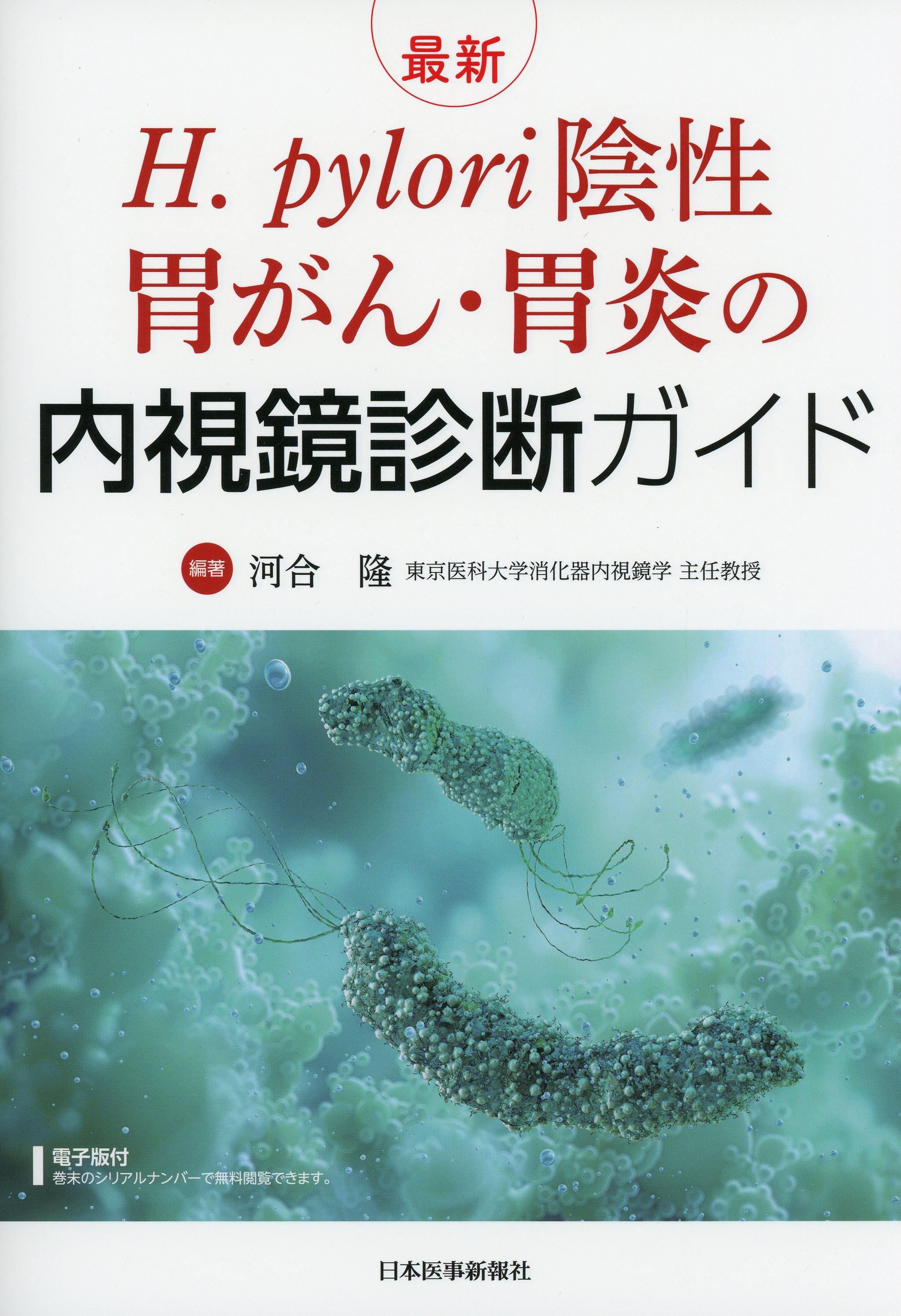 H. pylori陰性胃がん・胃炎の内視鏡診断ガイド