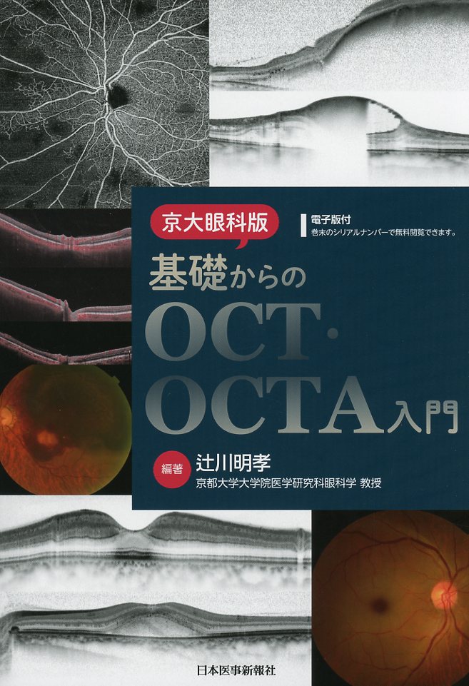 京大眼科版 基礎からのOCT・OCTA入門