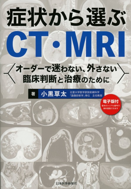 症状から選ぶCT・MRI　オーダーで迷わない、外さない臨床判断と治療のために