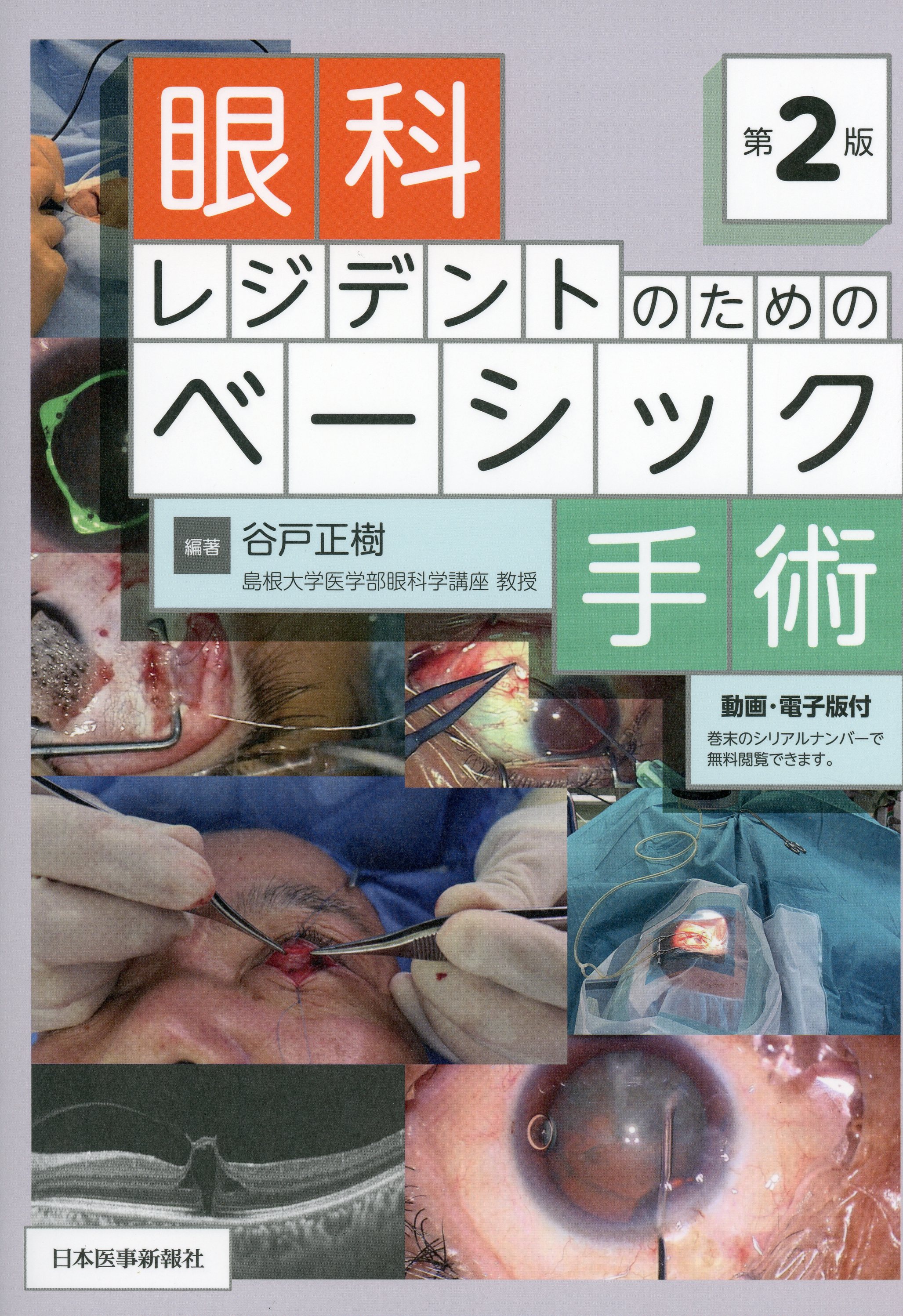 眼科レジデントのためのベーシック手術　第2版
