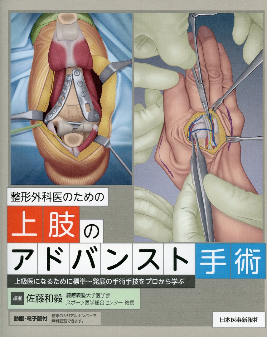 整形外科医のための上肢のアドバンスト手術