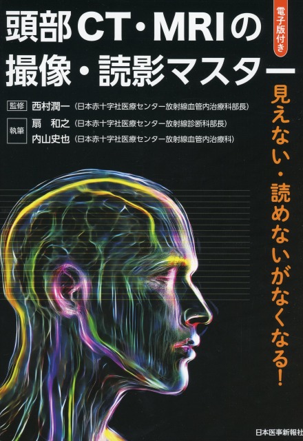 頭部CT・MRIの撮像・読影マスター