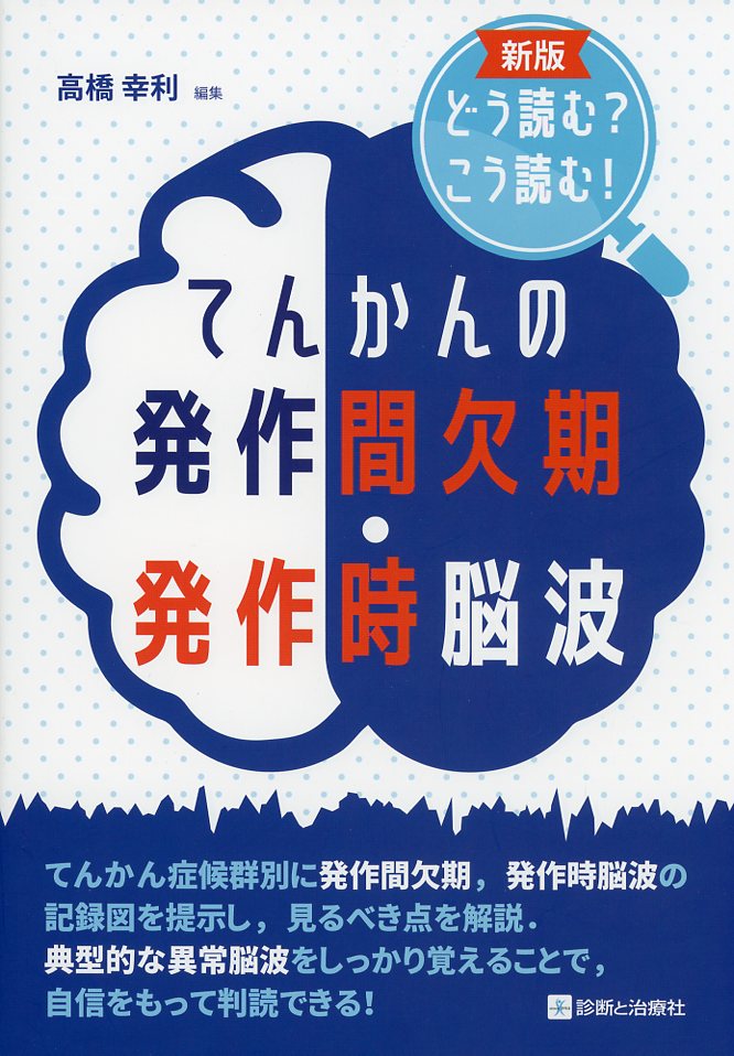 新版　どう読む？こう読む！ てんかんの発作間欠期・発作時脳波