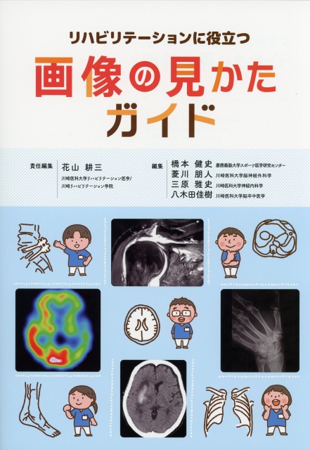 リハビリテーションに役立つ画像の見かたガイド