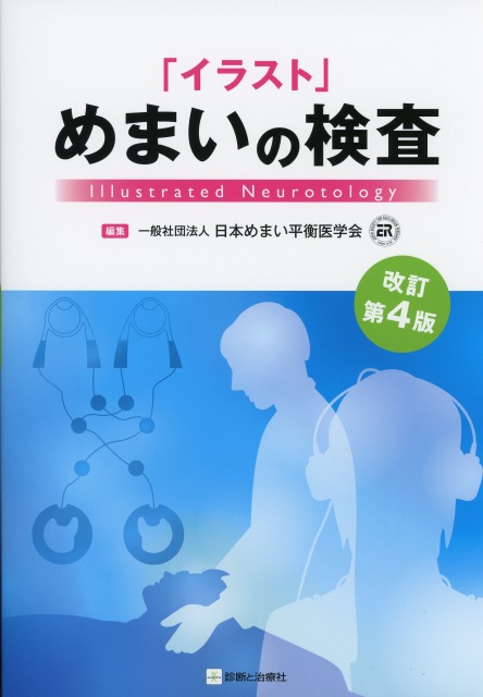 「イラスト」めまいの検査　改訂第4版