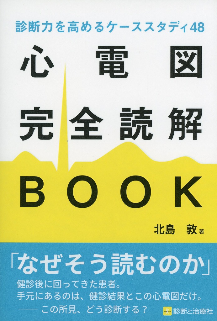 診断力を高めるケーススタディ48　心電図完全読解BOOK