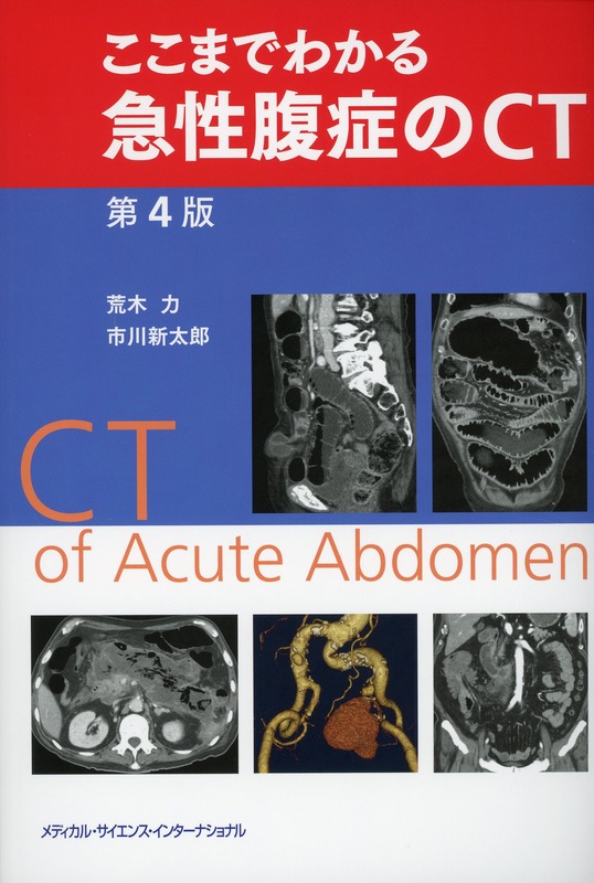 ここまでわかる急性腹症のCT　第4版