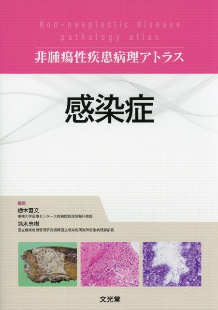 非腫瘍性疾患病理アトラス 感染症