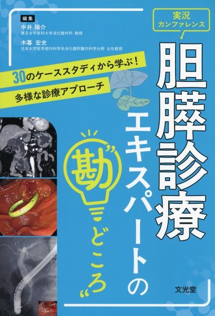 胆膵診療エキスパートの“勘どころ”
