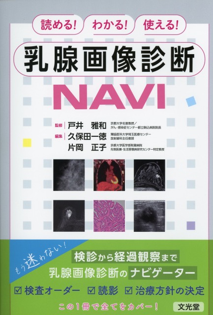 読める！わかる！使える！　乳腺画像診断NAVI