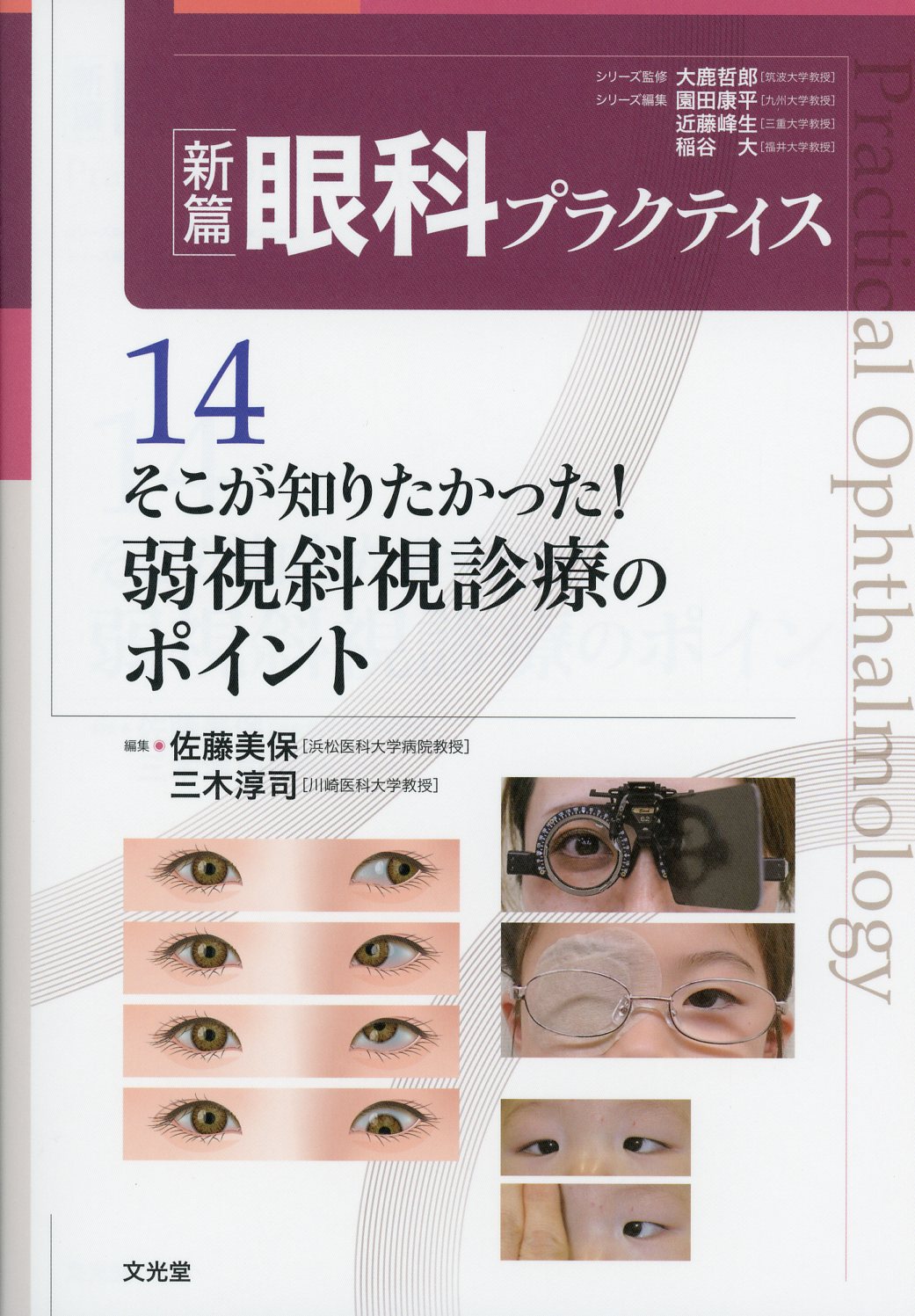 新篇眼科プラクティス　14　そこが知りたかった！弱視斜視診療のポイント