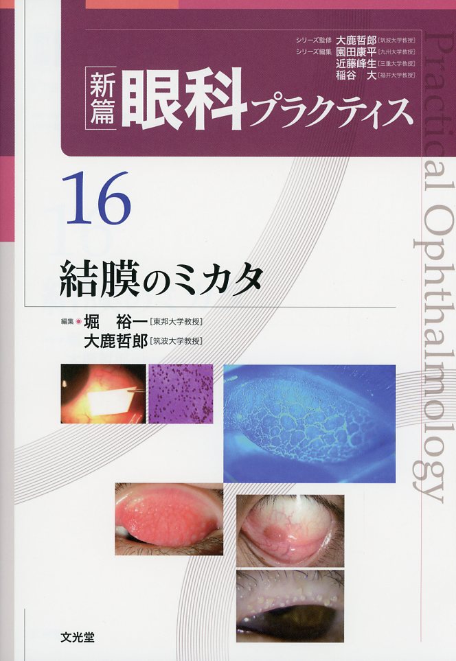新篇眼科プラクティス  16 結膜のミカタ