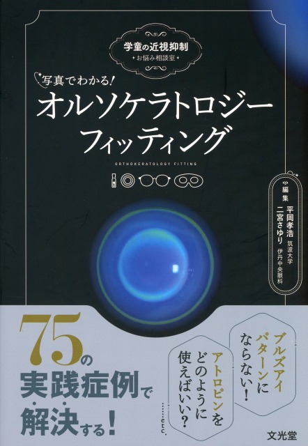 写真でわかる！ オルソケラトロジーフィッティング 学童の近視抑制 お悩み相談室