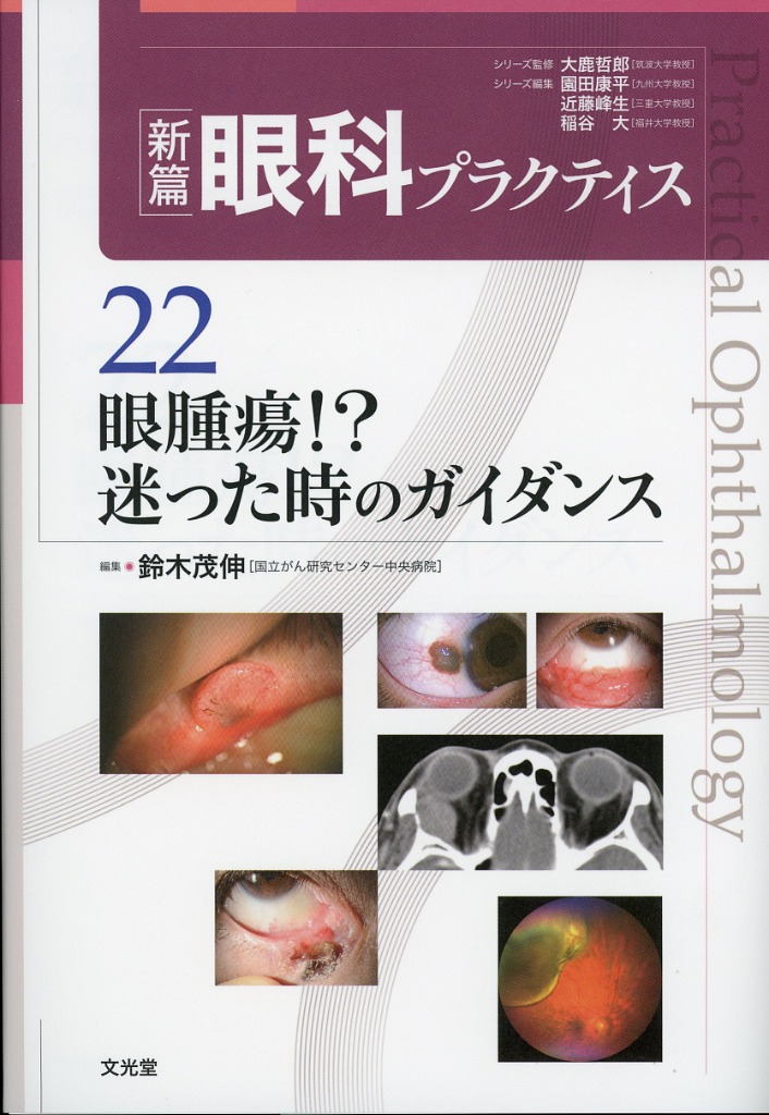 新篇眼科プラクティス　22　眼腫瘍！？　迷った時のガイダンス