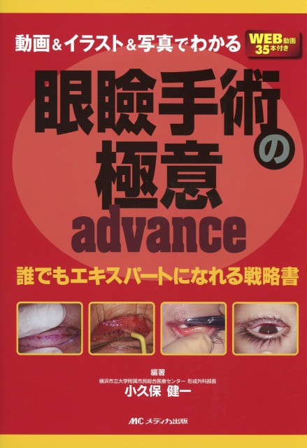 動画＆イラスト＆写真でわかる眼瞼手術の極意 advance