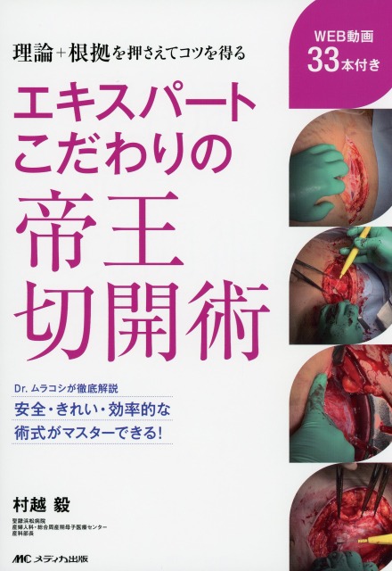 エキスパートこだわりの帝王切開術