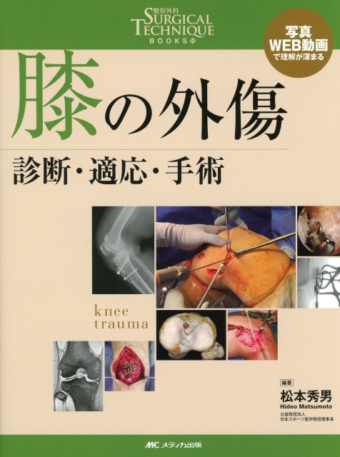 膝の外傷　診断・適応・手術
