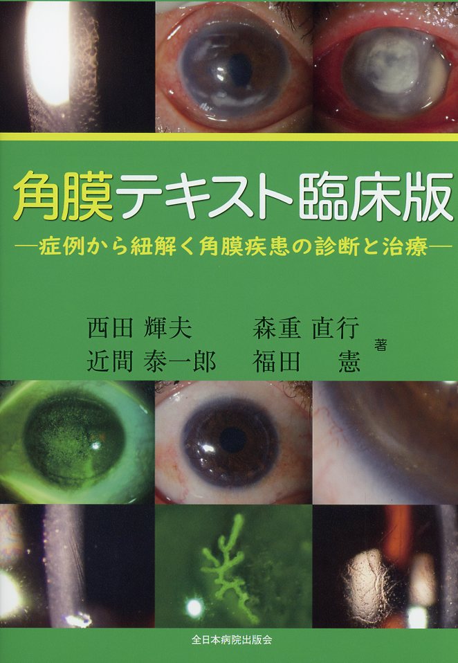 角膜テキスト臨床版―症例から紐解く角膜疾患の診断と治療―