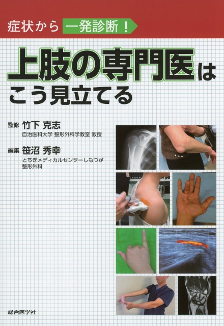 症状から一発診断！　上肢の専門医はこう見立てる