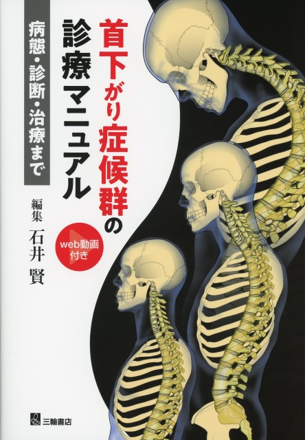 首下がり症候群の診療マニュアル　病態・診断・治療まで