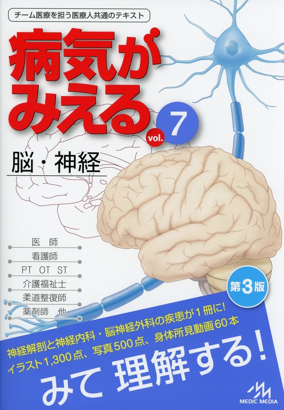 病気がみえる vol.7 脳・神経