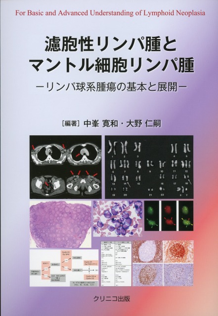 濾胞性リンパ腫とマントル細胞リンパ腫　リンパ球系腫瘍の基本と展開