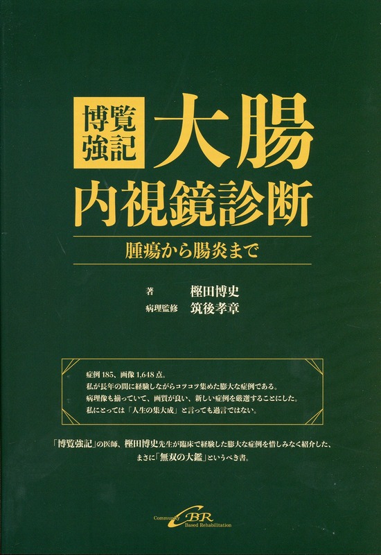 博覧強記 大腸内視鏡診断　腫瘍から腸炎まで