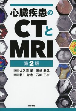 心臓疾患のCTとMRI 心臓疾患のCTとMRI 第2版 | 佐久間肇, 陣崎雅弘, 北川覚也, 石田正樹