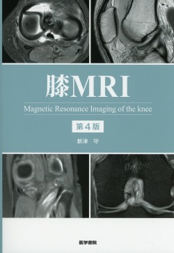 膝MRI　第4版