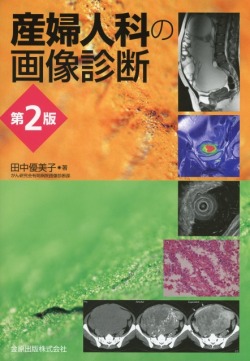 産婦人科の画像診断　第2版