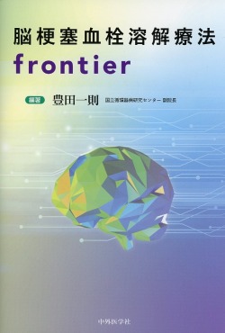 脳梗塞血栓溶解療法frontier