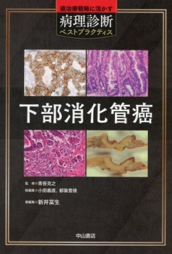 癌治療戦略に活かす病理診断ベストプラクティス　下部消化管癌