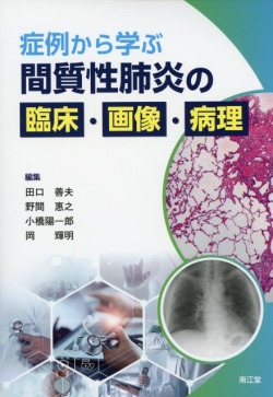 症例から学ぶ　間質性肺炎の臨床・画像・病理