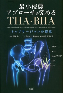 最小侵襲アプローチで究めるTHA・BHA　トップサージャンの極意
