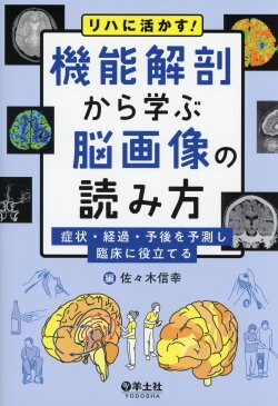 リハに活かす！　機能解剖から学ぶ脳画像の読み方