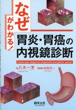 「なぜ」がわかる！胃炎・胃癌の内視鏡診断
