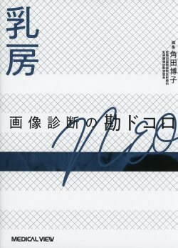 乳房 画像診断の勘ドコロNEO メジカルビュー社｜画像医学・放射線医学｜画像診断の勘ドコロ