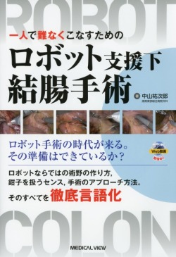 ロボット支援下結腸手術